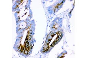 IHC analysis of Ataxin 1 using anti-Ataxin 1 antibody (ABIN3043506). (Ataxin 1 anticorps  (C-Term))