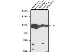 Western blot analysis of extracts of various cell lines, using COG4 antibody (ABIN7266486) at 1:1000 dilution. (COG4 anticorps  (AA 310-410))