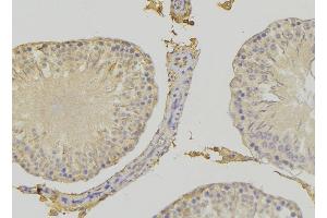 ABIN6272415 at 1/100 staining RAT testis tissue by IHC-P. (RHOBTB3 anticorps  (Internal Region))