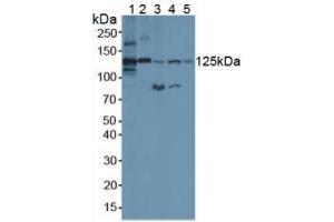Figure. (Complement C3 Convertase anticorps  (AA 1314-1663))