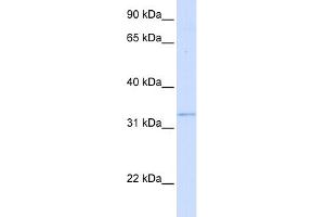 WB Suggested Anti-GGPS1 Antibody Titration:  0.