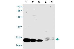 Western blot analysis of PCSK9 (prodomain) monoclonal antibody, clone KS-2C8 . (PCSK9 anticorps)