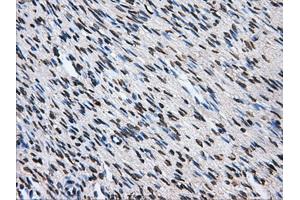 Immunohistochemistry (IHC) image for anti-ATP Synthase, H+ Transporting, Mitochondrial F1 Complex, beta Polypeptide (ATP5B) antibody (ABIN1496766)