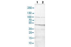 Western blot analysis of Lane 1: NIH/3T3 cell lysate and Lane 2: NBT-II cell lysate with CD36 polyclonal antibody . (CD36 anticorps  (AA 42-178))