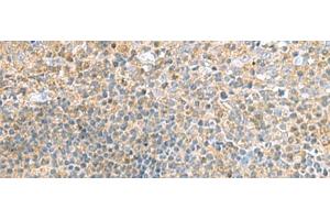 Immunohistochemistry of paraffin-embedded Human tonsil tissue using TSTA3 Polyclonal Antibody at dilution of 1:45(x200)