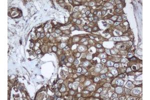 Image no. 4 for anti-Palmitoyl-Protein Thioesterase 1 (PPT1) (AA 100-306) antibody (ABIN1490802)