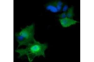 Image no. 2 for anti-HRas proto-oncogene, GTPase (HRAS) antibody (ABIN1498715) (HRAS anticorps)