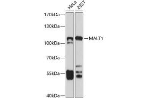 Western blot analysis of extracts of various cell lines, using M antibody (ABIN3023031, ABIN3023032, ABIN3023033, ABIN1513170 and ABIN6219356) at 1:1000 dilution. (MALT1 anticorps  (AA 125-450))