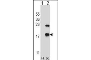 Western blot analysis of CRYAB (arrow) using rabbit polyclonal CRYAB Antibody (Center) (ABIN657620 and ABIN2846616). (CRYAB anticorps  (AA 84-112))