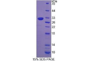 SDS-PAGE (SDS) image for Natural Cytotoxicity Triggering Receptor 1 (NCR1) (AA 17-258) protein (His tag) (ABIN6239365)