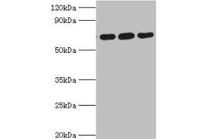 Western blot All lanes: ATAD3A antibody at 4 μg/mL Lane 1: A549 whole cell lysate Lane 2: Mouse spleen tissue Lane 3: Mouse liver tissue Secondary Goat polyclonal to rabbit IgG at 1/10000 dilution Predicted band size: 72, 67, 58 kDa Observed band size: 72 kDa (ATAD3A anticorps  (AA 1-240))