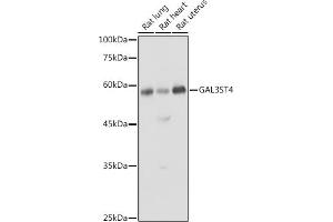 Western blot analysis of extracts of various cell lines, using GST4 antibody (ABIN6135004, ABIN6140932 and ABIN7101748) at 1:1000 dilution.