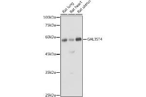 Western blot analysis of extracts of various cell lines, using GST4 antibody (ABIN6135004, ABIN6140932 and ABIN7101748) at 1:1000 dilution. (GAL3ST4 anticorps)