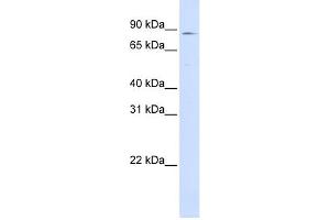 WB Suggested Anti-CPT1A Antibody Titration:  0. (CPT1A anticorps  (Middle Region))