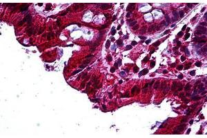 Human Colon: Formalin-Fixed, Paraffin-Embedded (FFPE) (TAB2 anticorps  (AA 161-173))