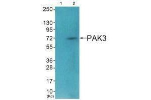 Western blot analysis of extracts from HeLa cells (Lane 2), using PAK3 (Ab-154) antiobdy.