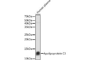 Western blot analysis of extracts of Human plasma cells, using Apolipoprotein C3 antibody (ABIN7265640) at 1:1000 dilution. (APOC3 anticorps)