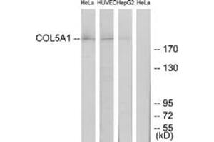 Western Blotting (WB) image for anti-Collagen, Type V, alpha 1 (COL5A1) (AA 301-350) antibody (ABIN2889916) (COL5A1 anticorps  (AA 301-350))