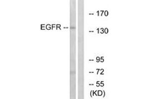 Western Blotting (WB) image for anti-Epidermal Growth Factor Receptor (EGFR) (AA 1161-1210) antibody (ABIN2888976) (EGFR anticorps  (AA 1161-1210))