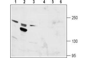 Western blot analysis of rat kidney (lanes 1 and 4), rat testis (lanes 2 and 5) and mouse kidney (lanes 3 and 6) lysates: - 1-3. (TRPM6 anticorps  (1st Extracellular Loop))