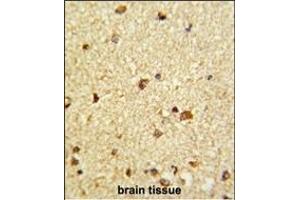 Formalin-fixed and paraffin-embedded human brain tissue reacted with CBFB Antibody (Center), which was peroxidase-conjugated to the secondary antibody, followed by DAB staining.