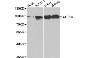 Western Blotting (WB) image for anti-Carnitine Palmitoyltransferase 1A (Liver) (CPT1A) antibody (ABIN1876495) (CPT1A anticorps)