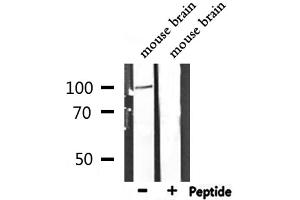 Western blot analysis of extracts from mouse brain, using DLG1 Antibody.