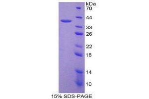 SDS-PAGE (SDS) image for Keratin 18 (KRT18) (AA 72-380) protein (His tag) (ABIN1878730) (Cytokeratin 18 Protein (AA 72-380) (His tag))