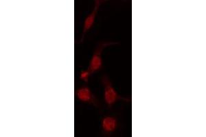 ABIN6274233 staining Hela cells by IF/ICC. (GTF2H1 anticorps  (N-Term))