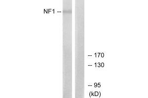 Western blot analysis of extracts from HepG2 cells, using NF1 antibody. (Neurofibromin 1 anticorps  (Internal Region))