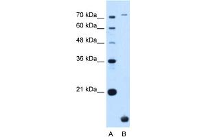 WB Suggested Anti-TMEM91 Antibody Titration:  0. (TMEM91 anticorps  (N-Term))