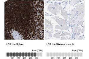 Immunohistochemical staining (Formalin-fixed paraffin-embedded sections) of human spleen and skeletal muscle tissues. (LCP1 anticorps  (AA 18-77))