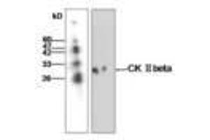 Image no. 1 for anti-Casein Kinase 2, beta (CSNK2B) antibody (ABIN791462) (CSNK2B anticorps)