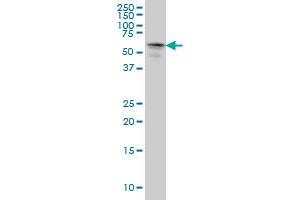 STK33 monoclonal antibody (M03), clone 4A12 Western Blot analysis of STK33 expression in HeLa .