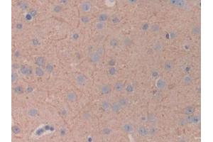 Detection of PDK4 in Mouse Cerebrum Tissue using Polyclonal Antibody to Pyruvate Dehydrogenase Kinase 4 (PDK4)