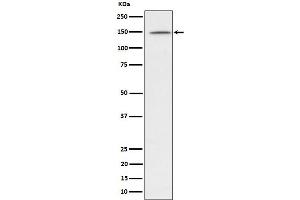Western blot analysis of phospho-Phospholipase C gamma 1/PLC-gamma-1  expression in Jurkat treated with Pervanadate lysate.
