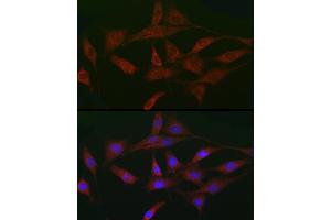 Immunofluorescence analysis of NIH/3T3 cells using A Rabbit pAb (ABIN3015791, ABIN3015792, ABIN3015793 and ABIN6219141) at dilution of 1:50 (40x lens). (ACVR2A anticorps  (AA 20-140))