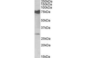 AP31405PU-N NMNAT3 antibody staining of Mouse Heart lysate at 0. (NMNAT3 anticorps  (Internal Region))