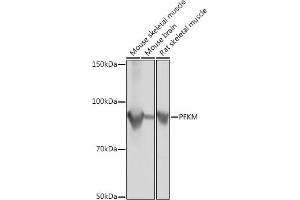 Western blot analysis of extracts of various cell lines, using PFKM Rabbit mAb (ABIN1678746, ABIN7101548, ABIN7101549 and ABIN7101550) at 1:1000 dilution. (PFKM anticorps)