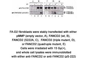 Image no. 2 for anti-Fanconi Anemia, Complementation Group D2 (FANCD2) (AA 217-226), (pSer222) antibody (ABIN363448)