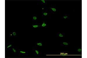 Immunofluorescence of monoclonal antibody to PSMB8 on HeLa cell.
