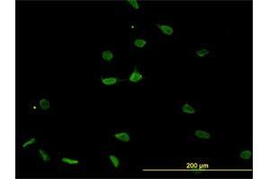 Immunofluorescence of monoclonal antibody to PSMB8 on HeLa cell. (PSMB8 anticorps  (AA 173-272))