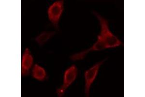 ABIN6274647 staining LOVO cells by IF/ICC. (Cytochrome P450 2C8/9/18/19 anticorps)