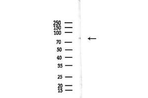 Western blot analysis of lysates from F10-LUC cells(UV,30 min treatment), using STRN4 Antibody at 1/1000 dilution.