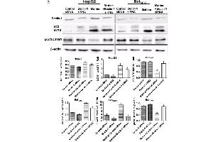 Effects of beclin-1 knockdown on matrine-induced autophagic flux and apoptosis in HepG2 and Bel7402 cells.