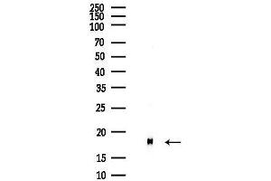 Western blot analysis of lysates from COLO205 cells(heat-shock,45 min treatment), using NME1 Antibody at 1/1000 dilution.