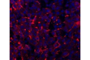 IF analysis of TAPA1/CD81 using anti-TAPA1/CD81 antibody (ABIN5693258). (CD81 anticorps  (AA 116-201))