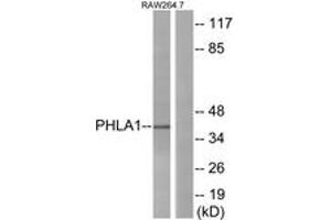 Western blot analysis of extracts from RAW264. (PHLDA1 anticorps  (AA 271-320))