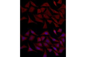 Immunofluorescence analysis of HeLa cells using TLR4 Rabbit pAb (ABIN6134489, ABIN6149223, ABIN6149226 and ABIN6220893) at dilution of 1:100 (40x lens).