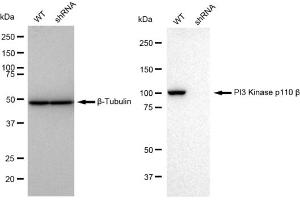 Western blotting analysis using PI3 Kinase p110 beta antibody (ABIN7799817). (Recombinant PIK3CB anticorps)